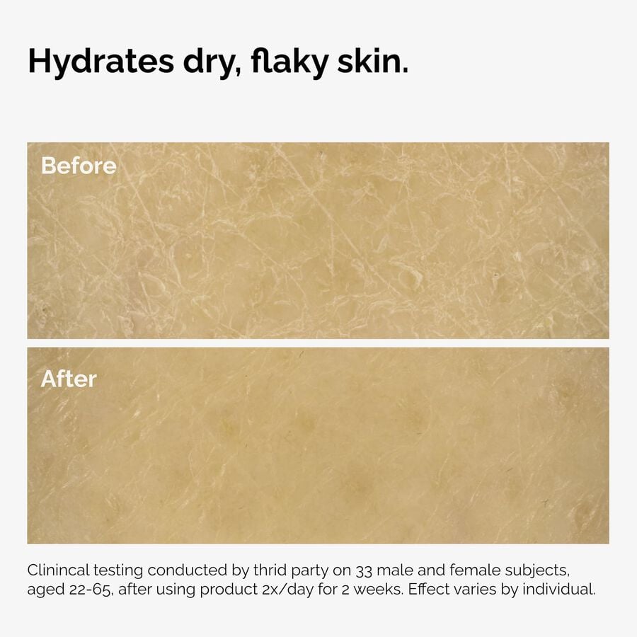 the-body-care-collection-x2 ord-natural-moisturizing-factors-inulin-body-before-after-graphic-02.jpg