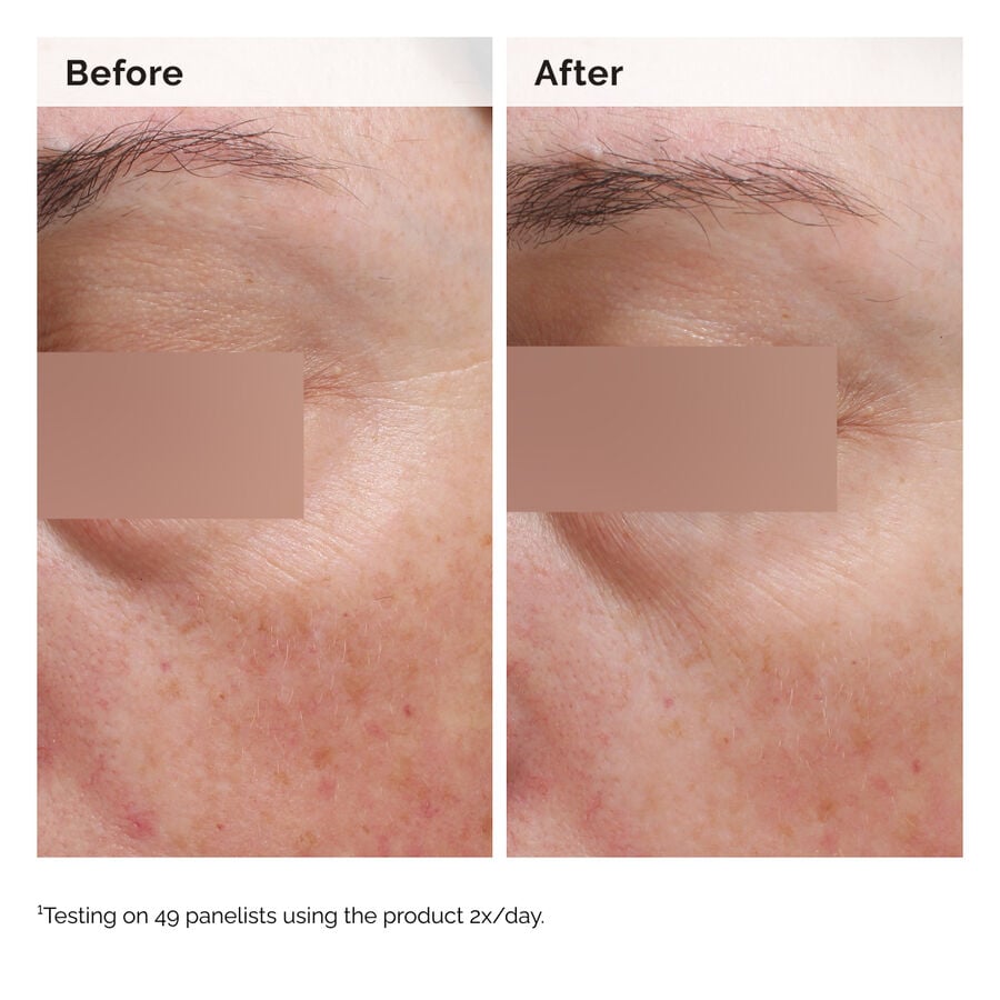 niacinamide-5-face-and-body-emulsion-x2 2024-08-23-ORD-Nia-5pct-Face-Body-B-A-Elasticity-Global-02-1x1.jpg