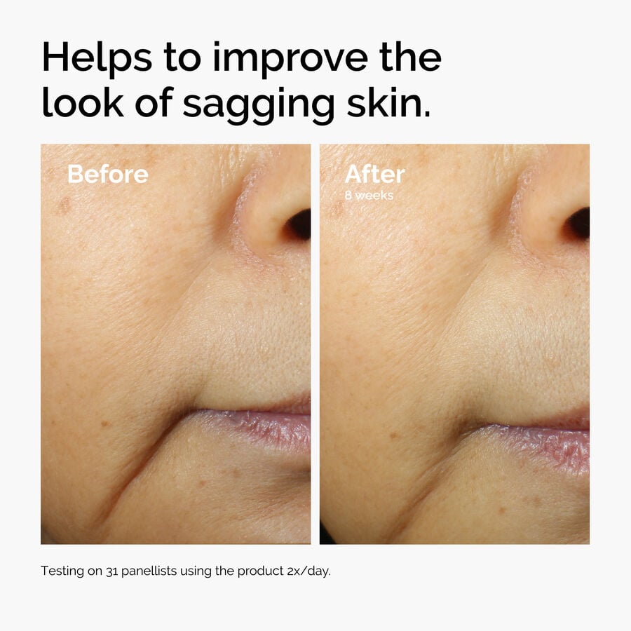 caffeine-3-escin-1-face-serum-z9 ord-caffeine-3pct-escin-1pct-face-serum-before-after-sagging.jpg