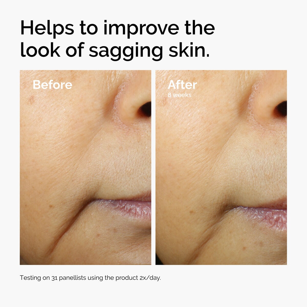 caffeine-3-escin-1-face-serum-z9 ord-caffeine-3pct-escin-1pct-face-serum-before-after-sagging.jpg