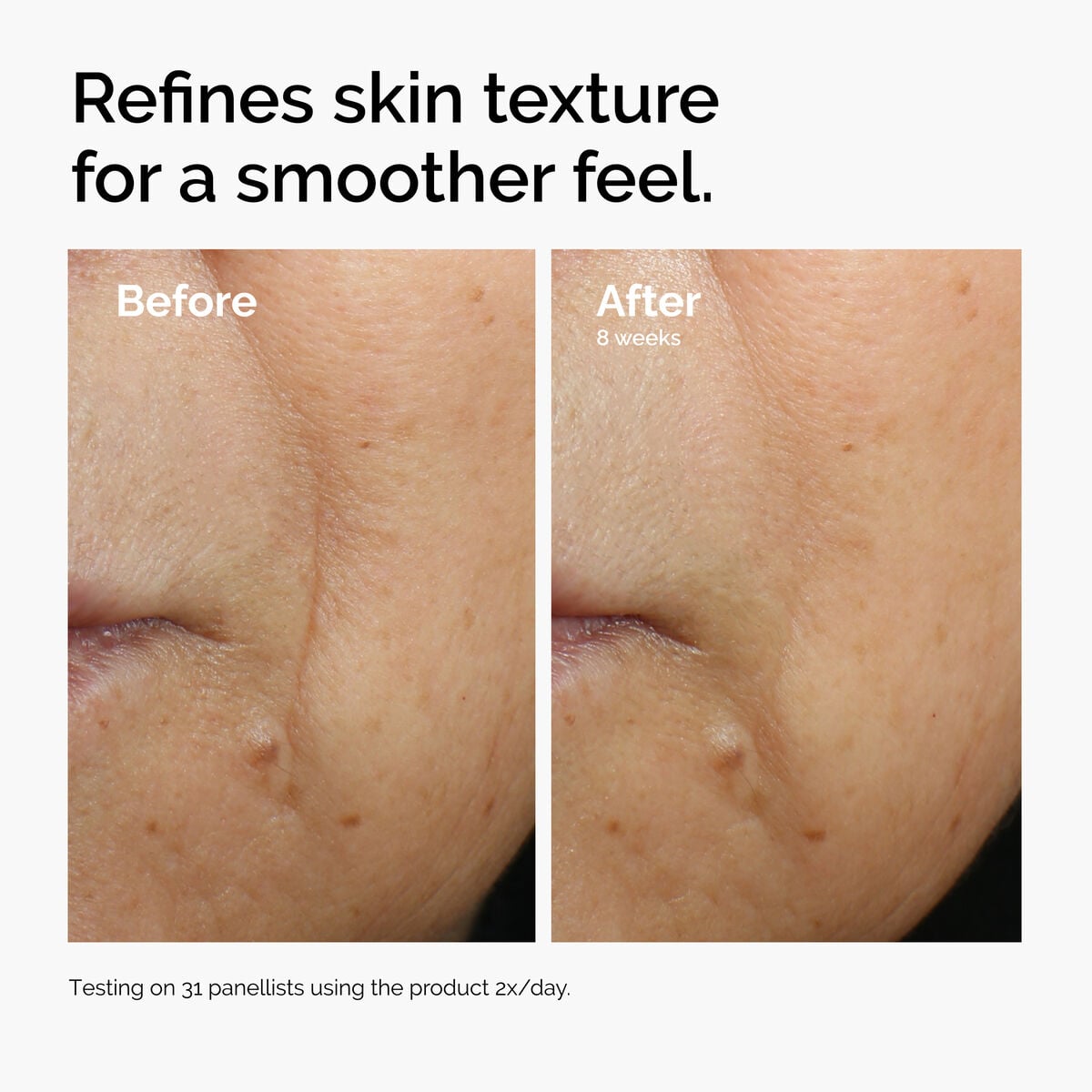 caffeine-3-escin-1-face-serum-z9 ord-caffeine-3pct-escin-1pct-face-serum-before-after-texture.jpg