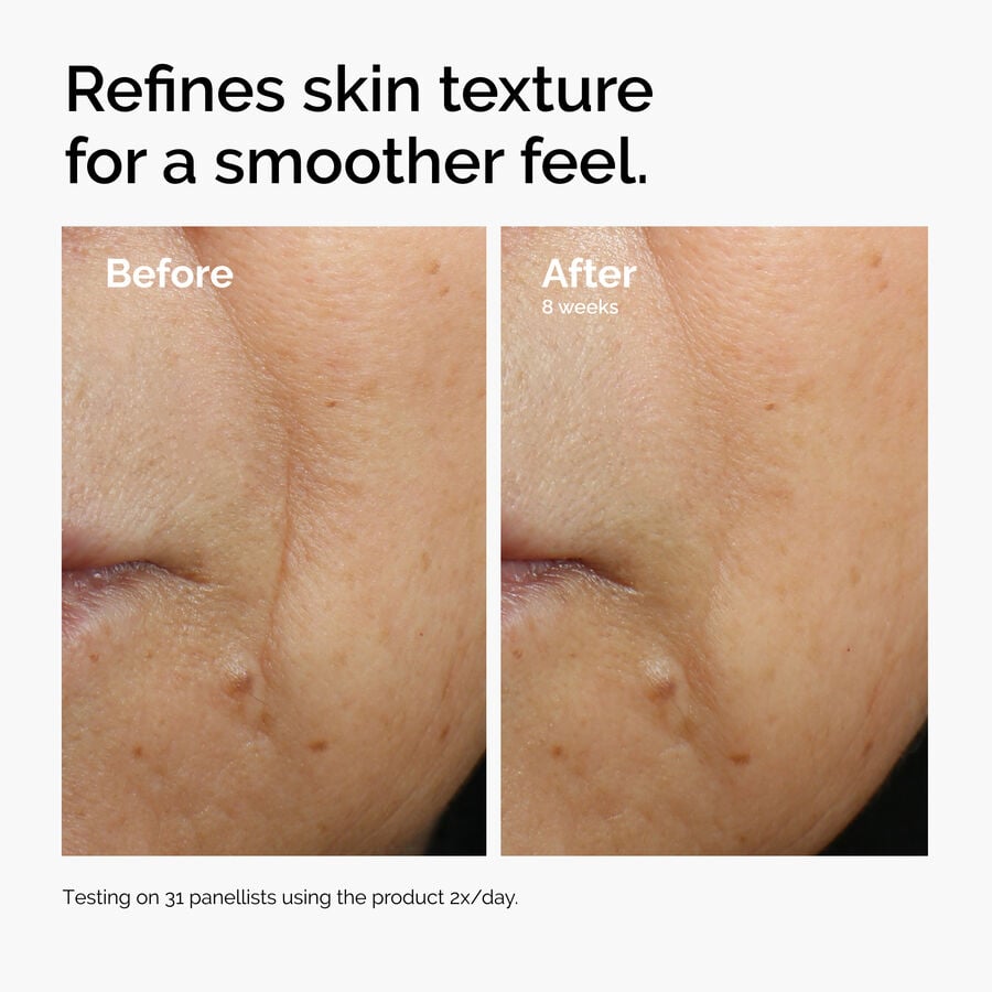 caffeine-3-escin-1-face-serum-z9 ord-caffeine-3pct-escin-1pct-face-serum-before-after-texture.jpg