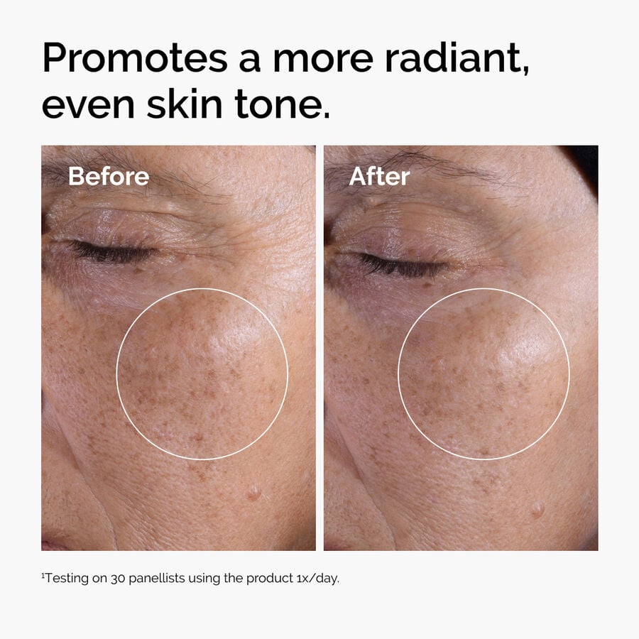 glycolic-acid-7-exfoliating-toner-q5 ord-glycolic-before-after-radiance.jpg