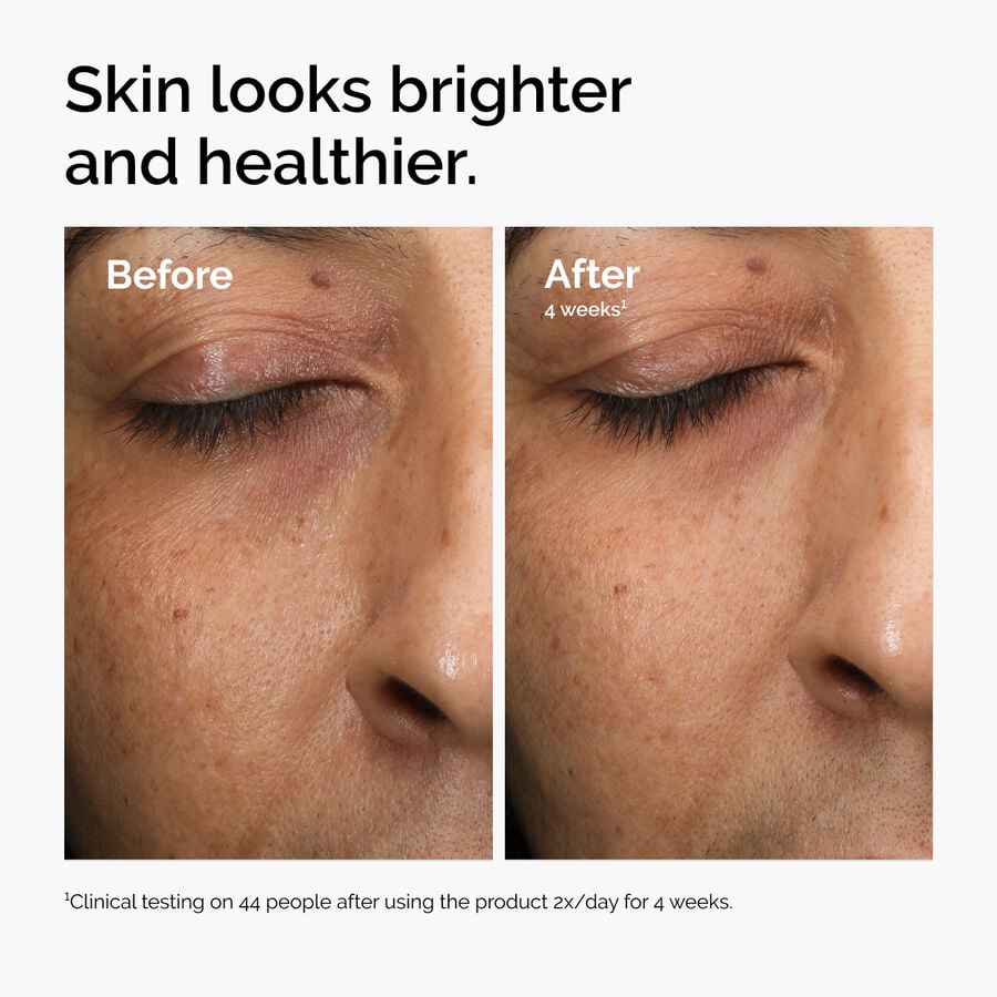multi-antioxidant-radiance-serum-u1 ord-mars-before-after-healthy.jpg