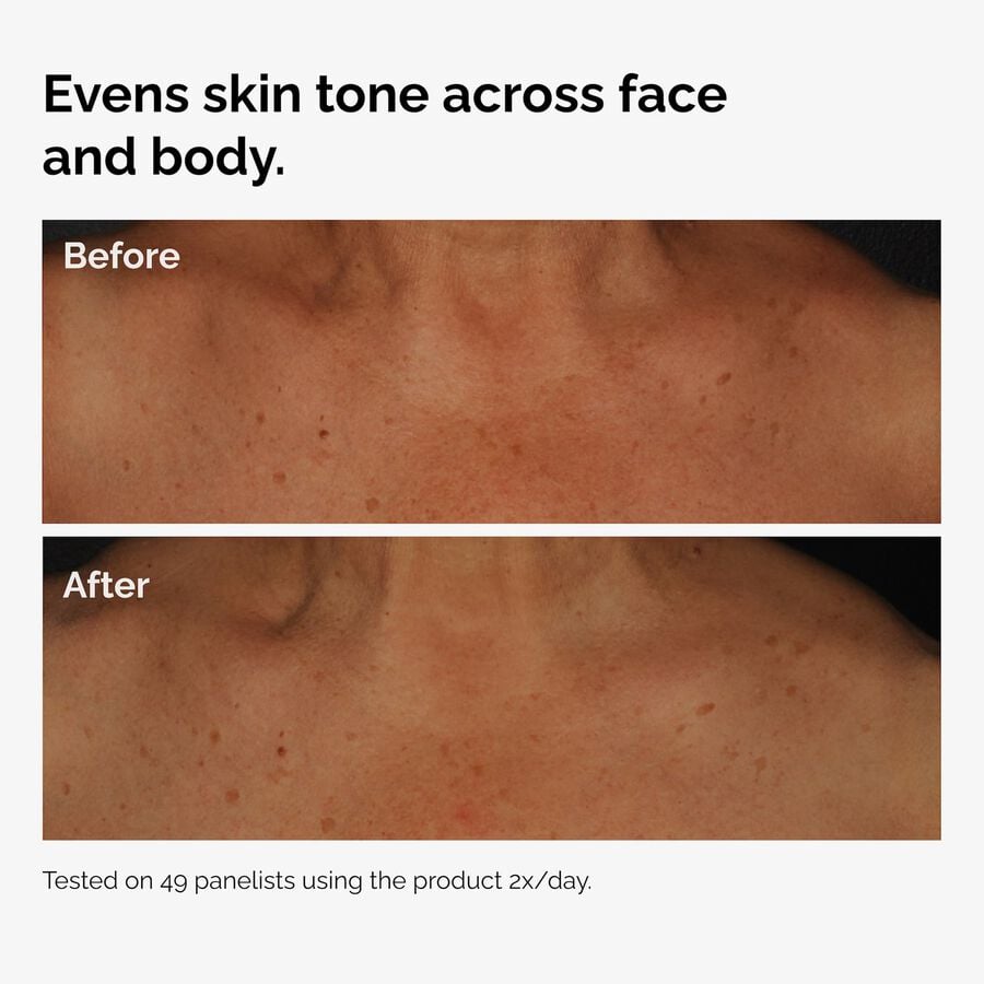 the-body-care-collection-x2 ord-niacinamide-face-body-serum-before-after-even-tone-graphic.jpg