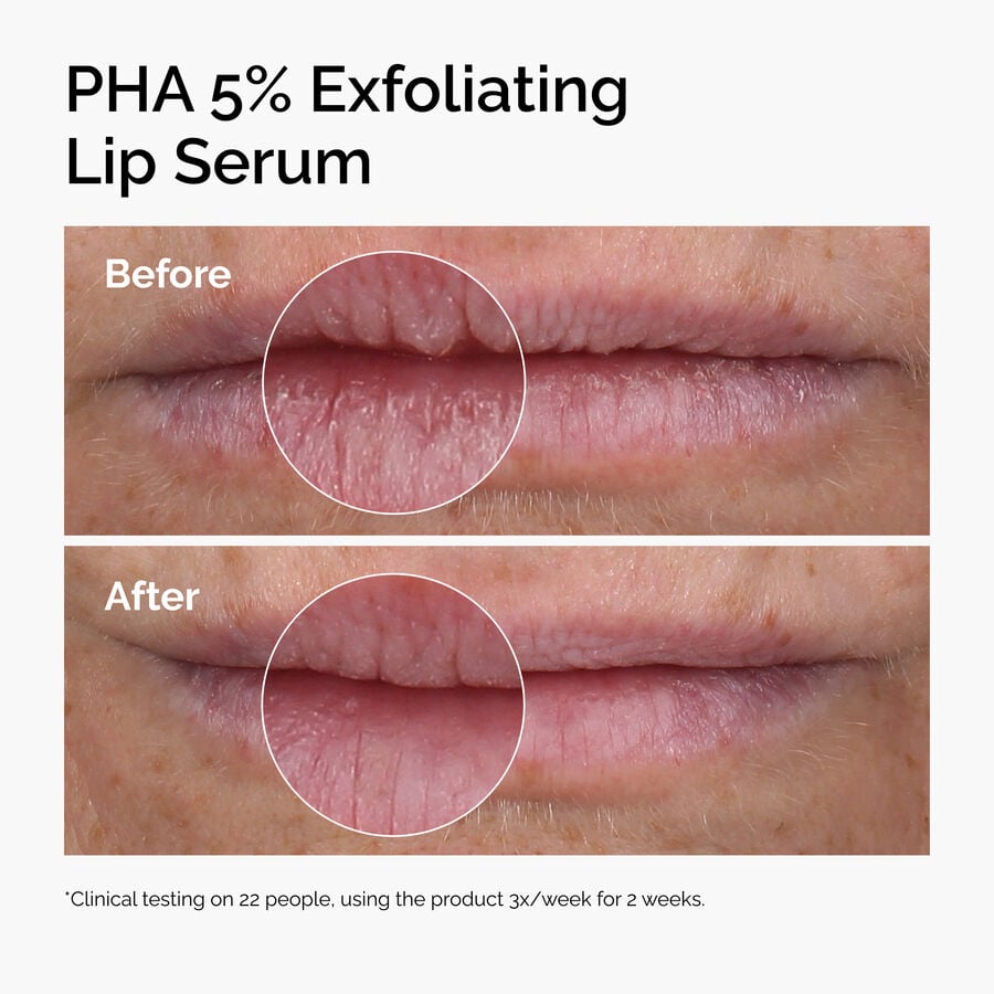 pha-5-exfoliating-lip-serum-h6 ord-pha-5pct-lip-exfoliating-serum-before-after.jpg