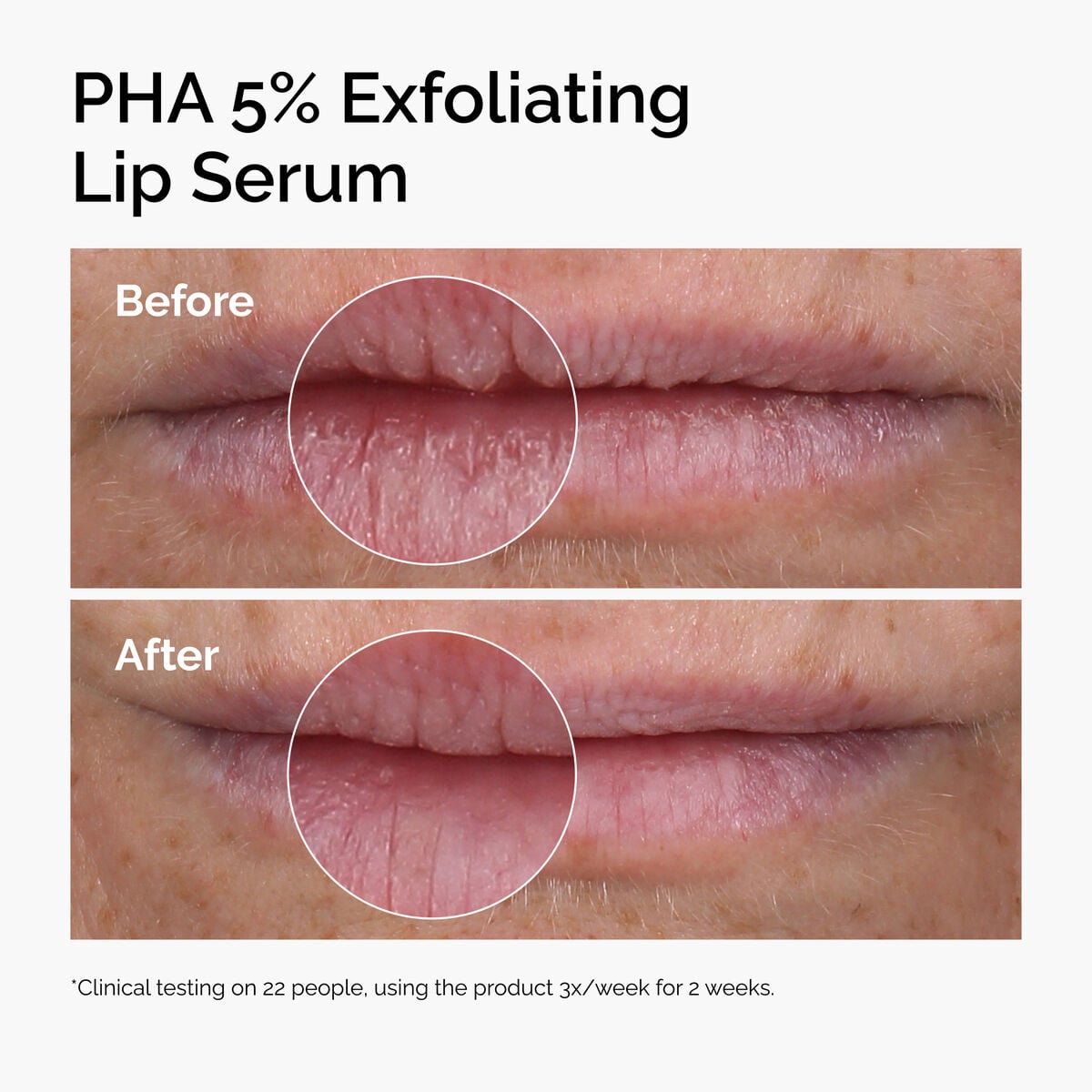 pha-5-exfoliating-lip-serum-h6 ord-pha-5pct-lip-exfoliating-serum-before-after.jpg